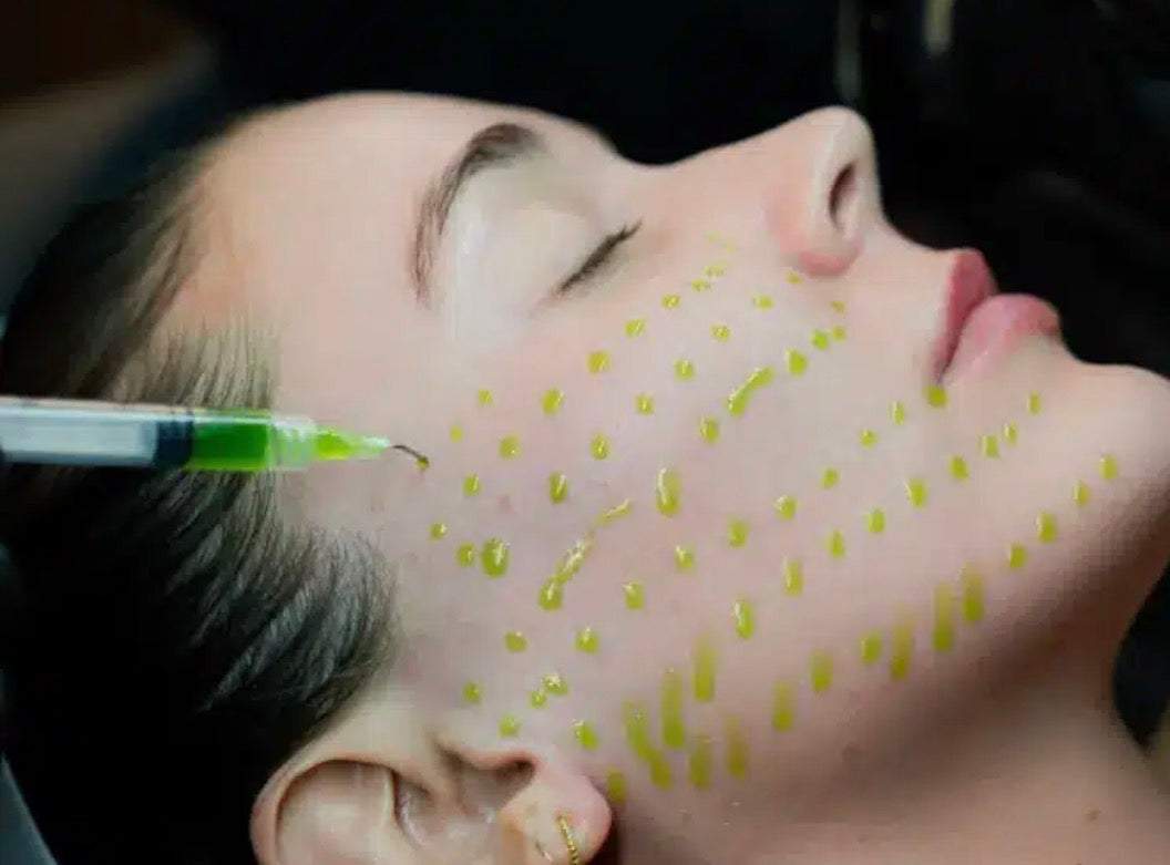 BioRePeel Facial