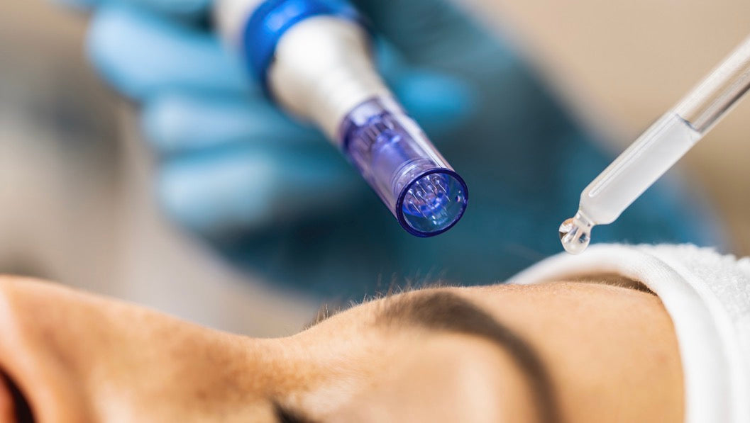 Microneedling w/ PDRN