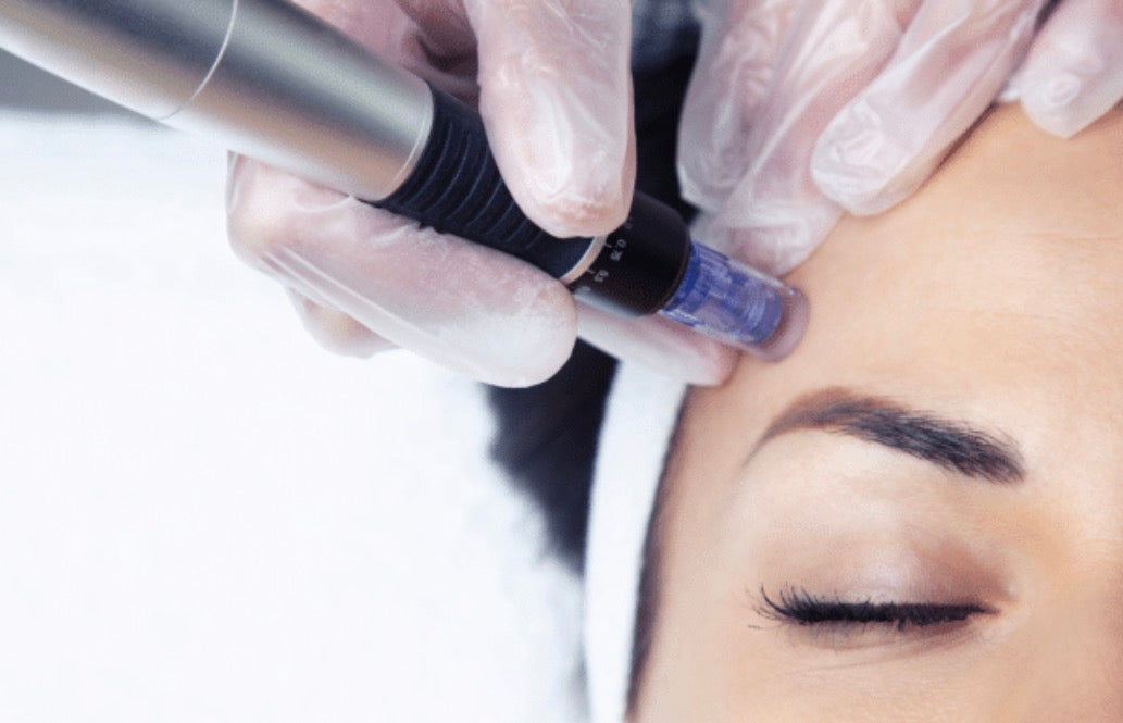 Microneedling w/ BioRePeel